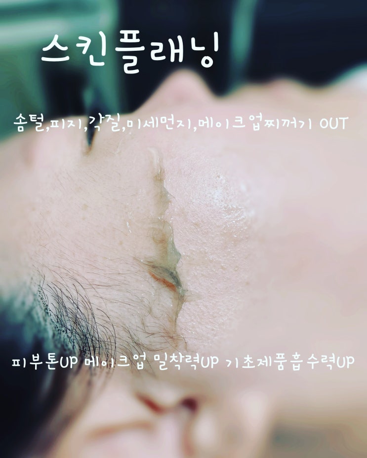  부산 동래 스킨 플래닝은 헤이 스킨이 진리