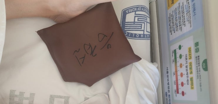  뇌동맥류 뇌혈관 조영술 이후 일주일/조영제 부작용,알러지 눈 붓기/성모병원 영상복사 비용,시간