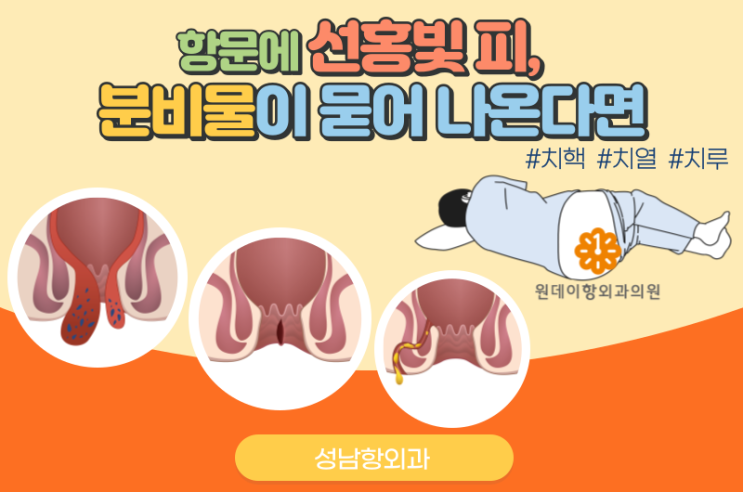  성남항외과 항문에 선홍빛 피, 분비물 묻어 나온다면