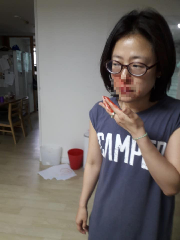 동거남 의혹보도 나오자···피투성이 사진 올린 황보승희 동거남 의혹보도 나오자···피투성이 사진 올린 황보승희
