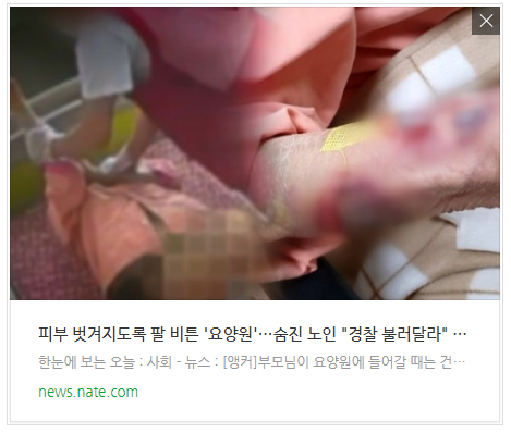 피부 벗겨지도록 팔 비튼 '요양원'…숨진 노인 "경찰 불러달라" 호소 피부 벗겨지도록 팔 비튼 '요양원'…숨진 노인 "경찰 불러달라" 호소
