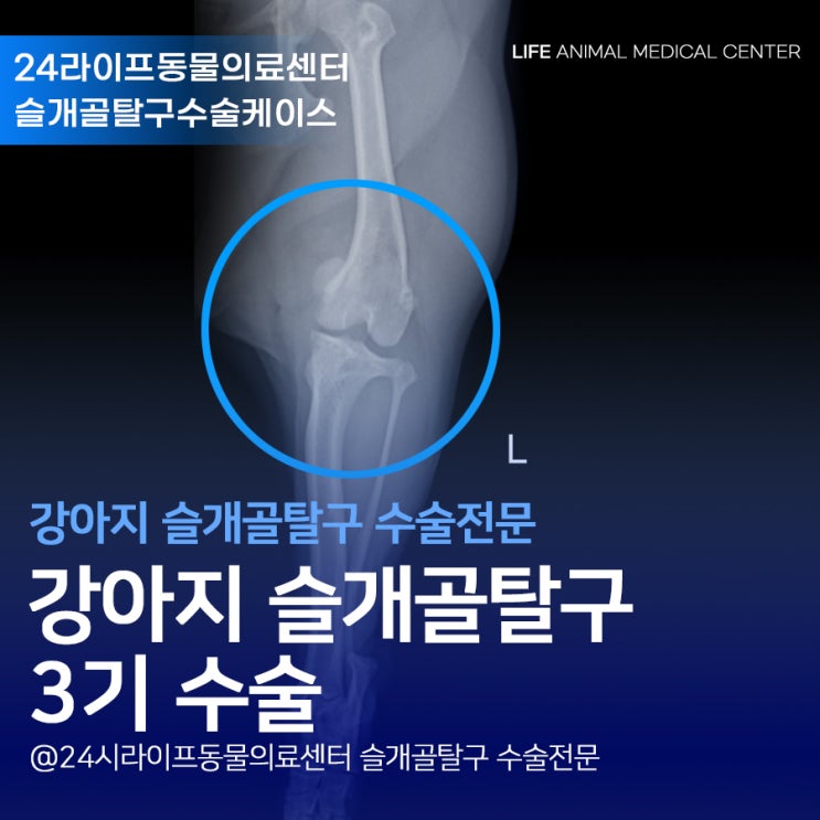 대구 강아지슬개골탈구수술전문 : 4살 비숑 슬개골탈구 3기수술