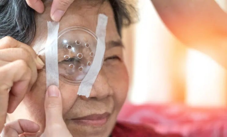 백내장 수술, 실손보험 되나? 안 되나? 백내장 수술, 실손보험 되나? 안 되나?