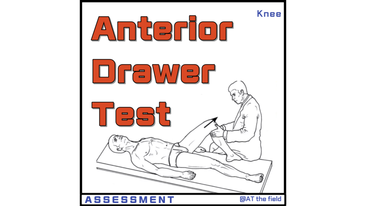 Anterior Drawer Test / 전방십자인대 파열 및 불안정성 검사,전방십자인대 손상 검사 / 무릎 이학적 검사, special test, 무릎 전방전위 검사, 앞당김검사