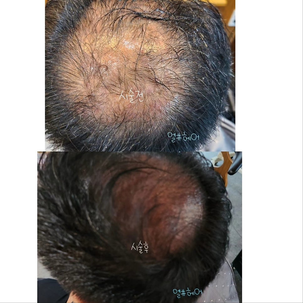 엘샵헤어 사진 2