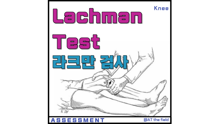 Lachman Test(라크만 검사) / 전방십자인대 손상 검사,안정성 검사, 파열 검사 /무릎 이학적 검사, special test