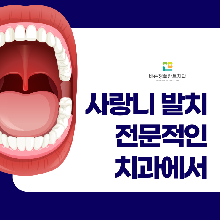  부산북구사랑니 발치는 전문가가 있는 치과로