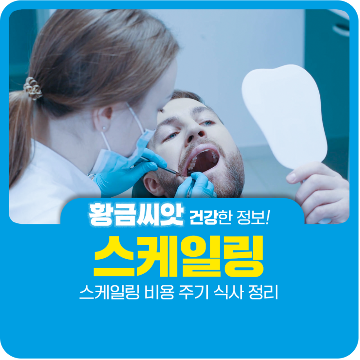  스케일링 비용 주기 정리