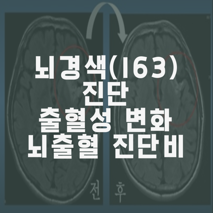 뇌경색(I63)진단과 MRI상 출혈성변화(hemorrhagic transformation), 뇌출혈 진단비 부지급 타당한가?
