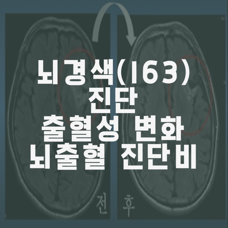  뇌경색(I63)진단과 MRI상 출혈성변화(hemorrhagic transformation), 뇌출혈 진단비 부지급 타당한가?