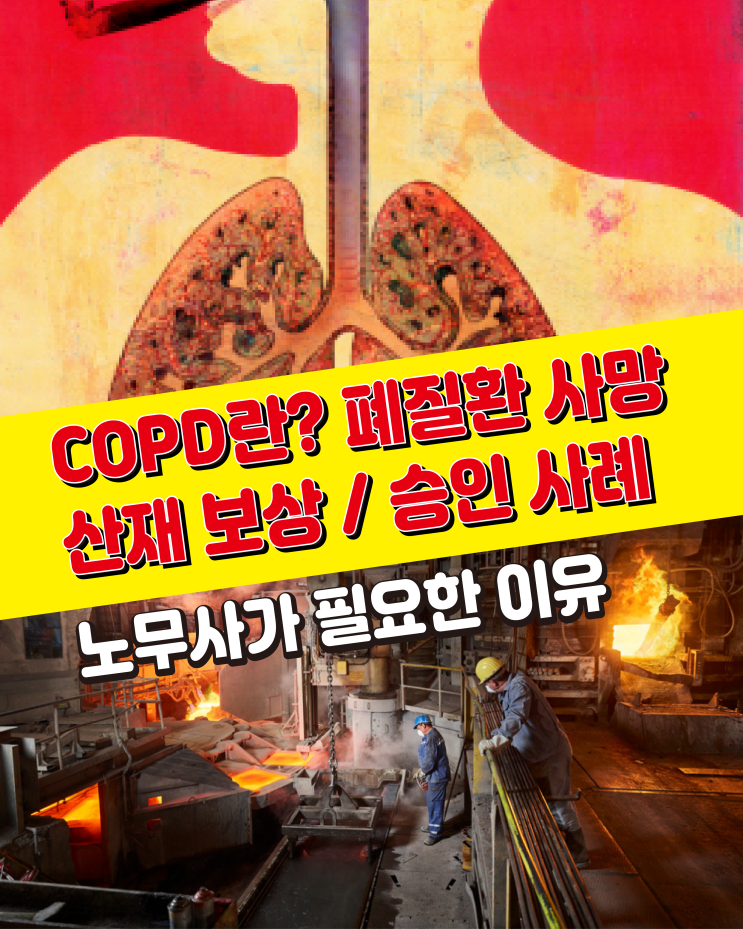 [만성폐쇄성폐질환] COPD란? 산재신청 및 보상금액 / 요양 중 사망사례 / 대구 부산 노무사