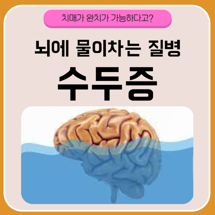  완치가 가능한 치매? 수두증. 증상과 치료 한번에 알아보기