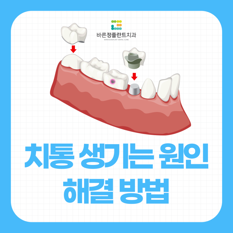  화명동치과 이유없이 치아가 아플때 치통 원인 대처방법