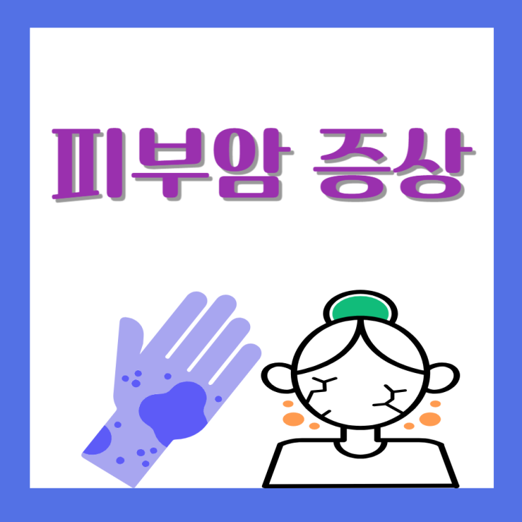 피부암 증상 원인 피부 흑색종 초기증상 점 구별하고 치료 알아봐요 피부암 증상 원인 피부 흑색종 초기증상 점 구별하고 치료 알아봐요