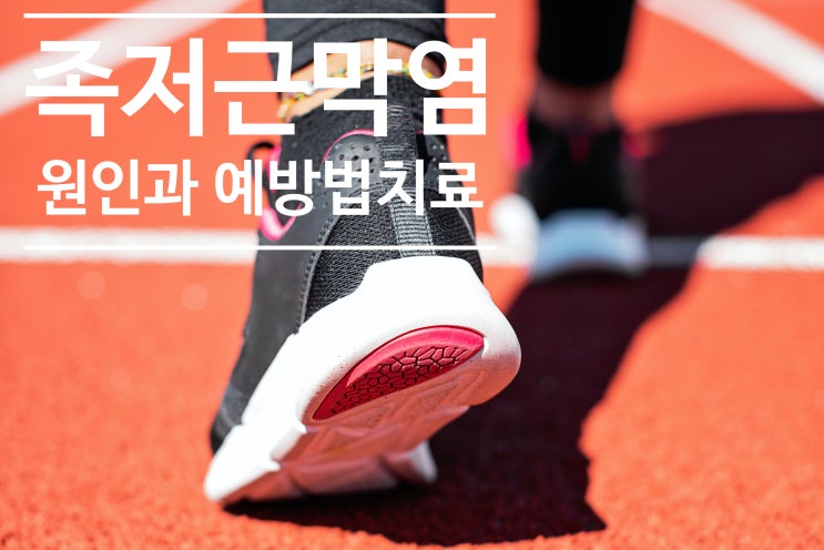  족저근막염 발바닥 발아치 통증 원인 초기 증상 예방법 치료방법 스트레칭