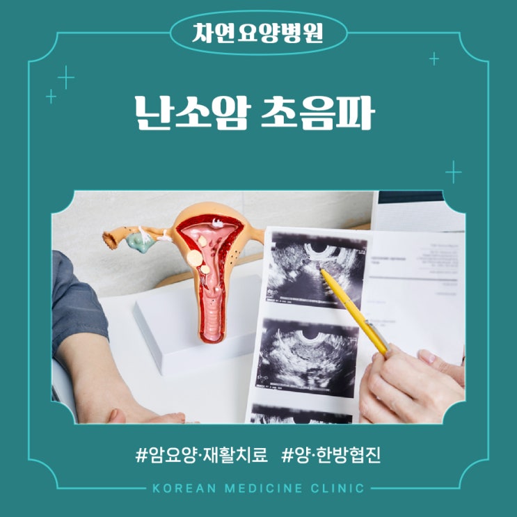  난소암 위험군 정기적인 초음파 검사 필요