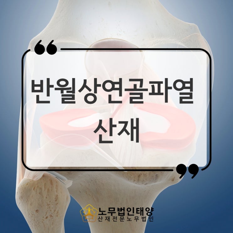  부천노무사, 반월상연골파열 산재 무릎 관절염 보상 받으려면