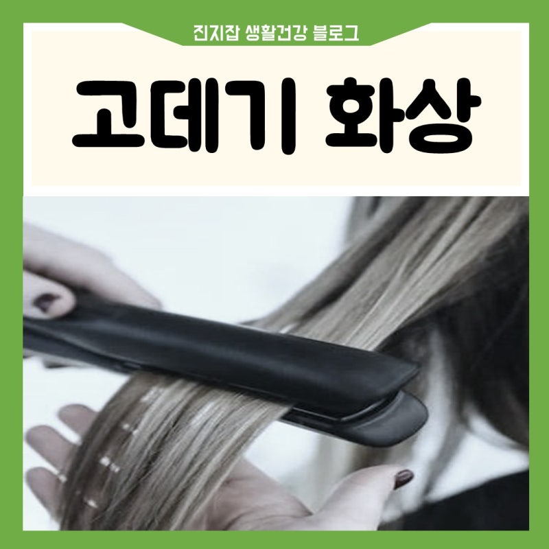 고데기 화상 데임 연고 메디폼 이마 얼굴 흉터 밴드