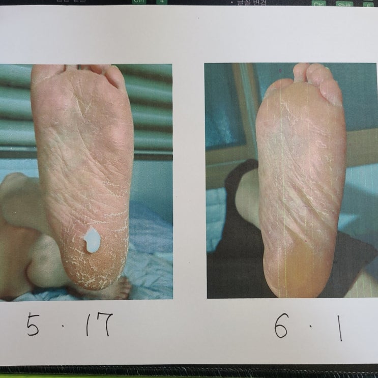  발각질연화제를  자녀가 굳은살 많은 부모님께 선물하면좋겠어요