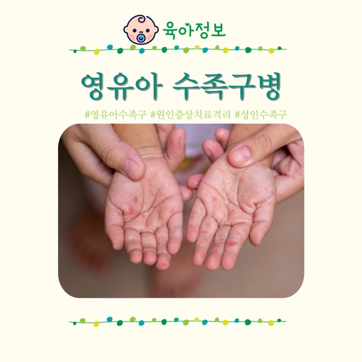  영유아 수족구 수포 구내염 증상 원인 치료 병원 전염 잠복기 격리 성인