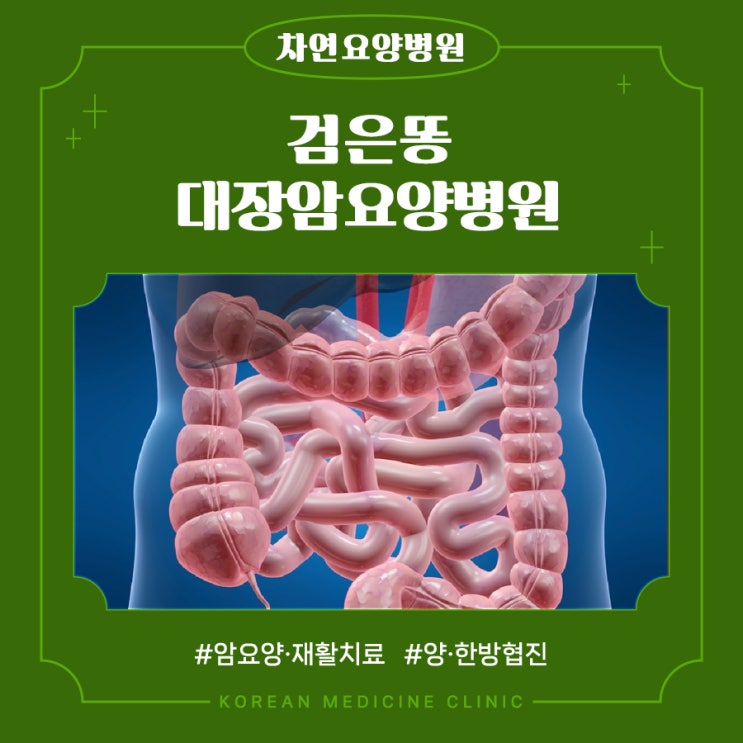  검은똥 잔변감 대장암 배변습관 관찰 중요