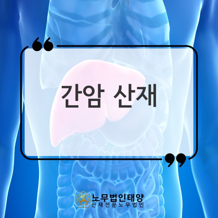  간암 산재 승인받기 위한 핵심은, 김포/고양/일산노무사