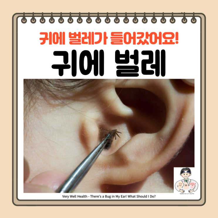  귀에 벌레 바퀴벌레 들어갔을 때, 증상 응급처치법 제거