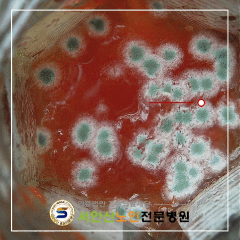  안산요양병원 식중독 예방방법