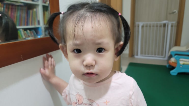  우리 아기 바이러스성 피부염 손 발 배 얼굴 발진 두드리진시럽 처방 받았어요 두드러기인가?