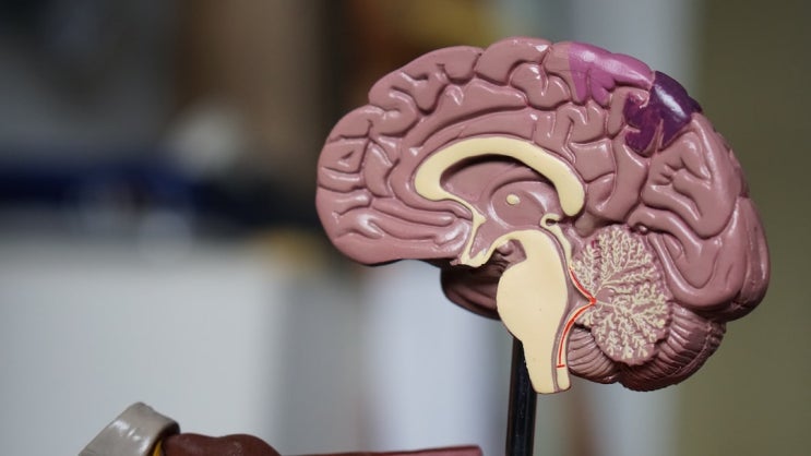 뇌졸중이 두통…보험금이 0원이라면?