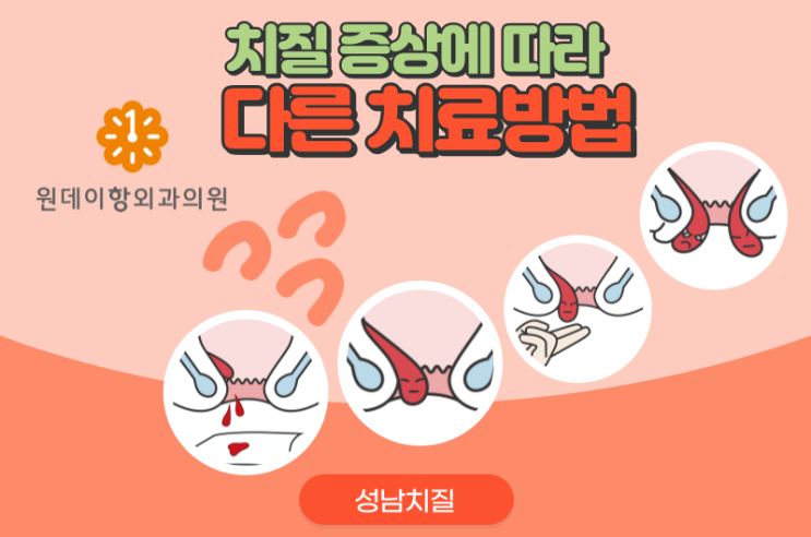  성남치질 증상에 따라 다른 치료방법 공유합니다.