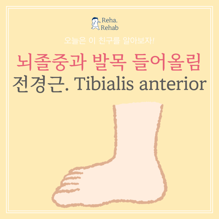 뇌졸중과 발목을 들어올리는 근육 전경근(Tibialis anterior)