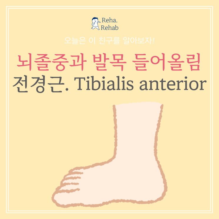 뇌졸중과 발목을 들어올리는 근육 전경근(Tibialis anterior)
