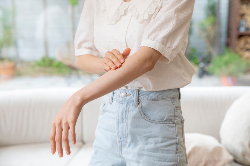 어루러기의 원인 증상 검사 전염성? 치료(연고 약), 예방 및 재발, 소아(아기)도? 어루러기(tine....