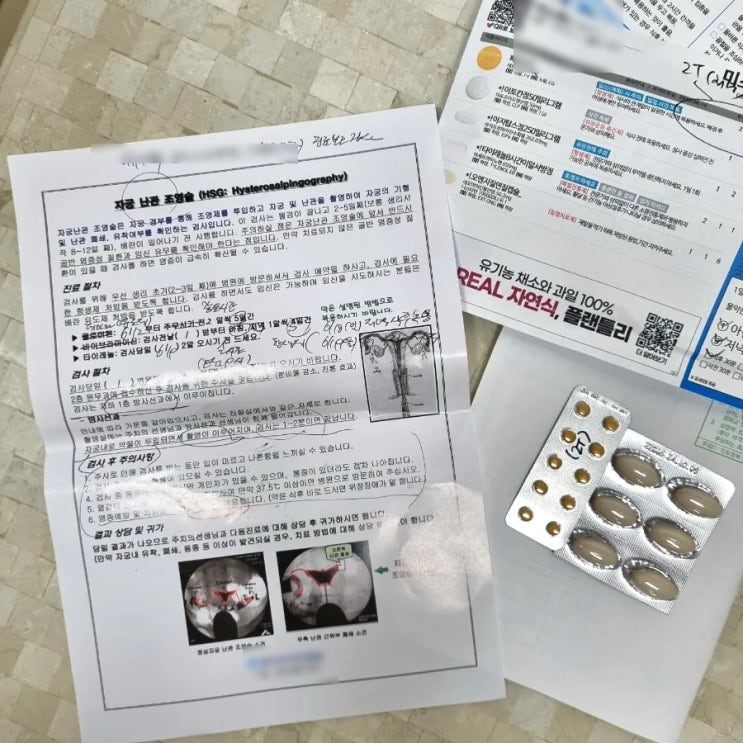 노원난임병원에서 나팔관조영술 받고 온 후기 (난임진단서, 통증, 결과, 주의사항, 가격)