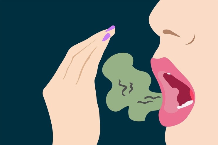 후비루 때문에 입냄새 심해진 거 치료방법이 있나요?