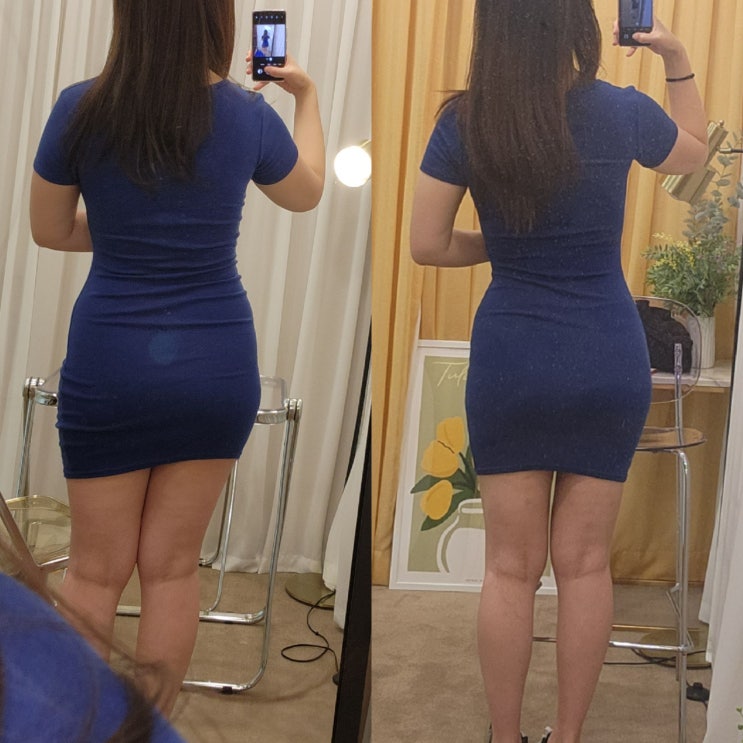  [대전지방추출주사] 허벅지 람스 3개월 결산