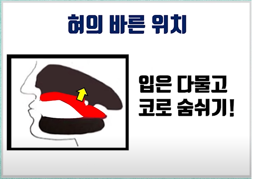 부작용 없이 뮤잉운동 하는 방법 알려드립니다! 무턱, 주걱턱, 이중턱, 긴얼굴에 효과 만점! #뮤잉운동 #압구정역한의원 #압구정 ...