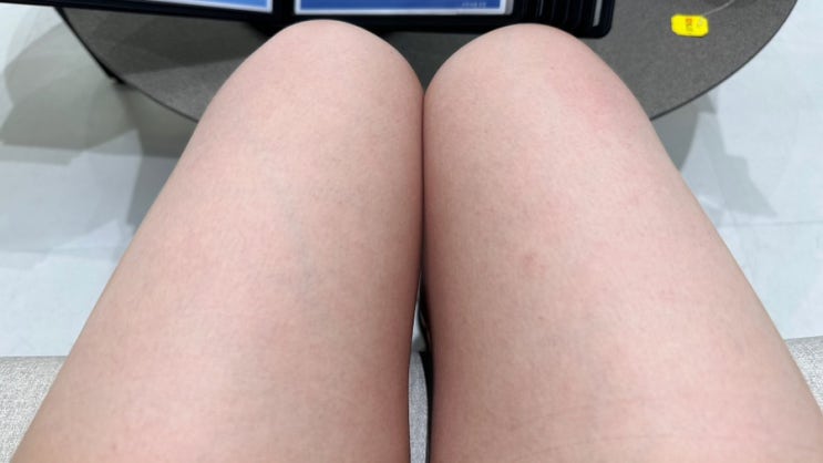  신중동역 피부과 여름휴가 준비 레이저제모 3회차