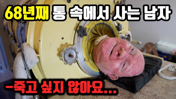 68년 동안 통 속에 갇혀 사는 남자 68년 동안 통 속에 갇혀 사는 남자