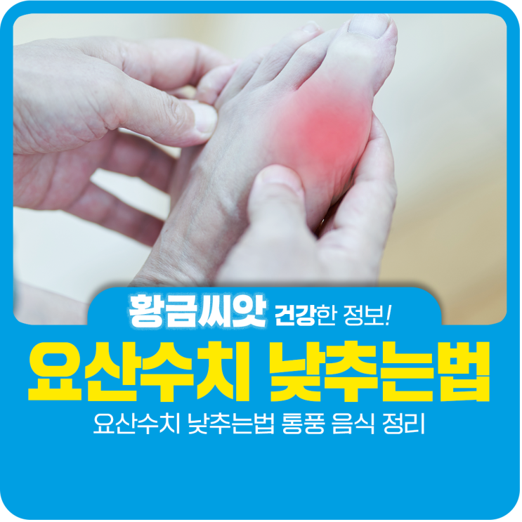  요산수치 낮추는법 통풍 음식 정리
