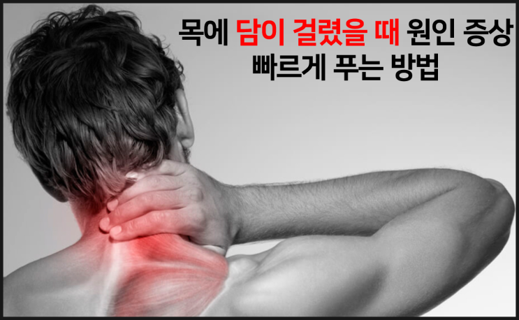  목에 담 걸렸을 때 빨리 푸는 방법 (목 어깨 뻐근할 때)