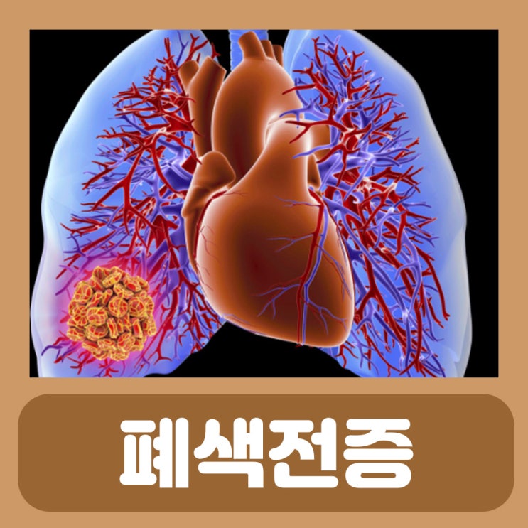  선천성 후천선 오타모반 원인 치료