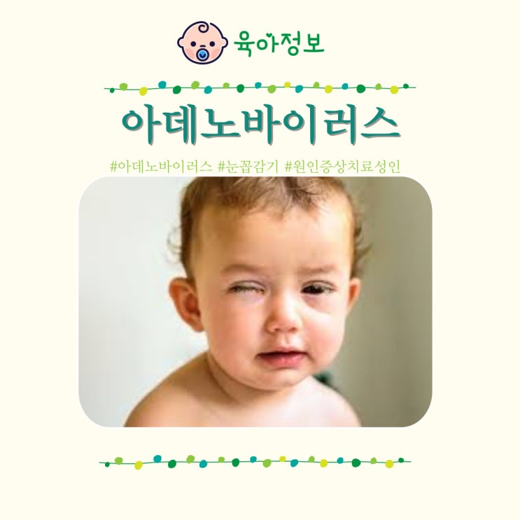  아데노바이러스 눈꼽감기 바이러스 증상 전염 치료 어린이집 성인