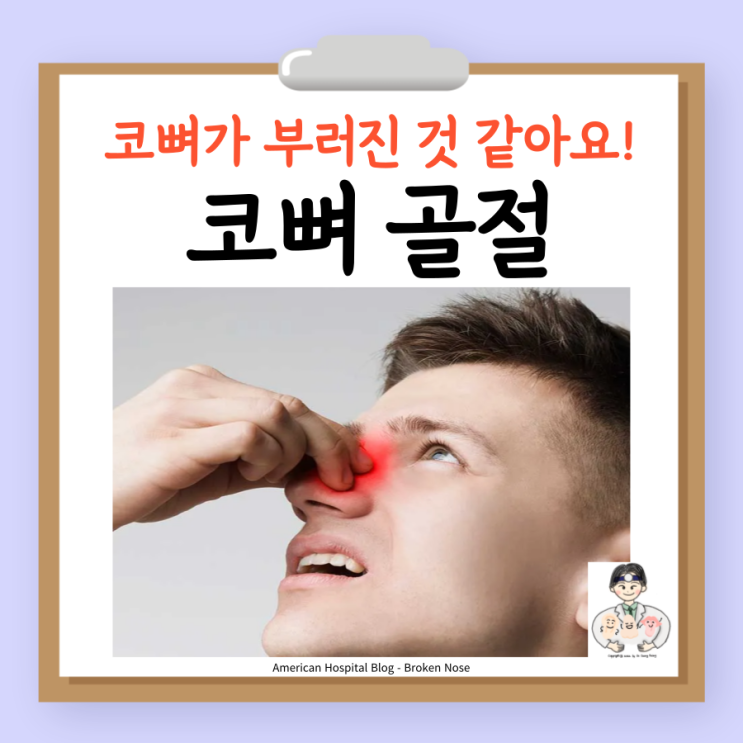  코뼈 골절 부러지면 비골 골절 증상 진단 수술