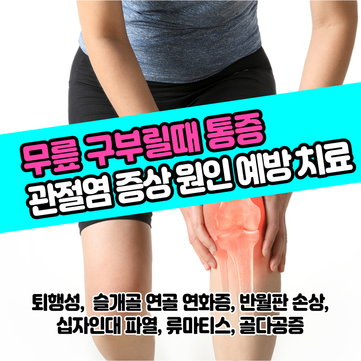  [건강정보] 무릎 통증 관절염 증상 원인 예방 및 치료 / 슬관절 퇴행성, 십자인대 파열, 슬개골연골연화증, 반월판손상 산재보험 확인