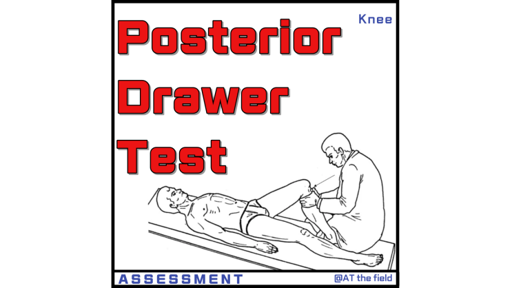 Posterior Drawer Test(후방 전위 검사) / 후방십자인대 파열 및 손상 검사, 무릎 불안정성 검사, 무릎 이학적 검사, special test