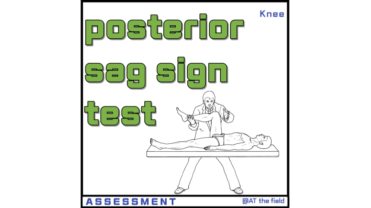 Posterior Sag sign Test(후방 처짐 징후 검사) /  Godfrey's test,Step off Test / 후방십자인대 파열 검사, 무릎 이학적 검사
