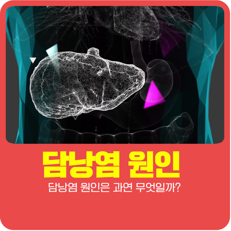  담낭염 원인은 과연 무엇일까?
