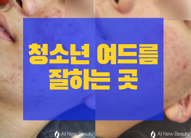  배곧 학생 여드름, 이런 데는 가지 마세요.